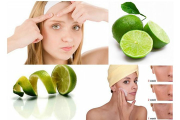 Phương pháp điều trị mụn bọc có mủ hiệu quả an toàn tận gốc