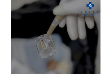 Quá sửng sốt trước tác dụng của Nano Basic tế bào gốc