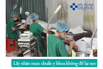 Quy trình điều trị mụn và sẹo rỗ an toàn hiệu quả