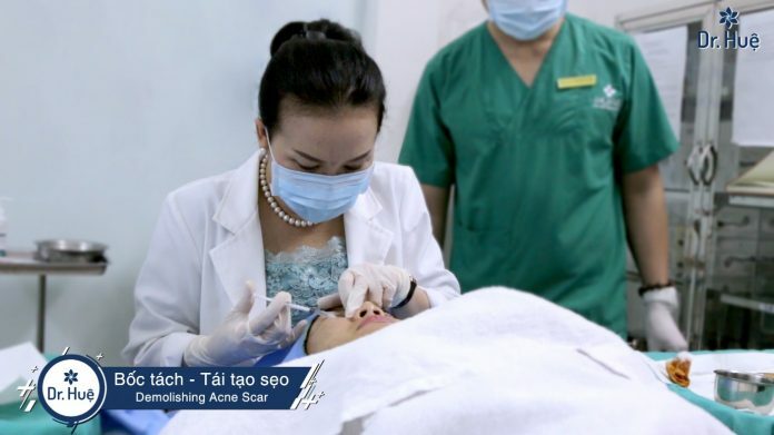 Quy trình tách sẹo được thực hiện như thế nào? - Điều trị mụn Dr Huệ - Hình 1