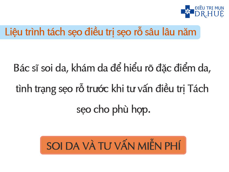 Quy trình tách sẹo được thực hiện như thế nào? - Điều trị mụn Dr Huệ - Hình 2