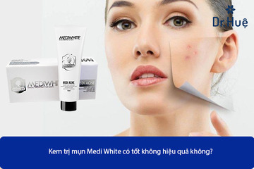 [Review] Kem Trị Mụn Medi White Có Tốt Hiệu Quả Không?