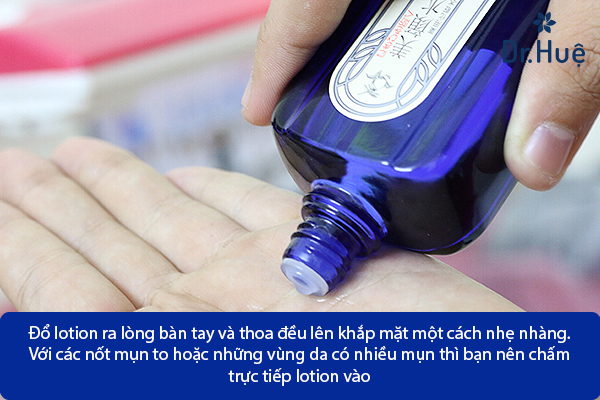 [Review] Lotion Trị Mụn Của Nhật Có Tốt Hay Không
