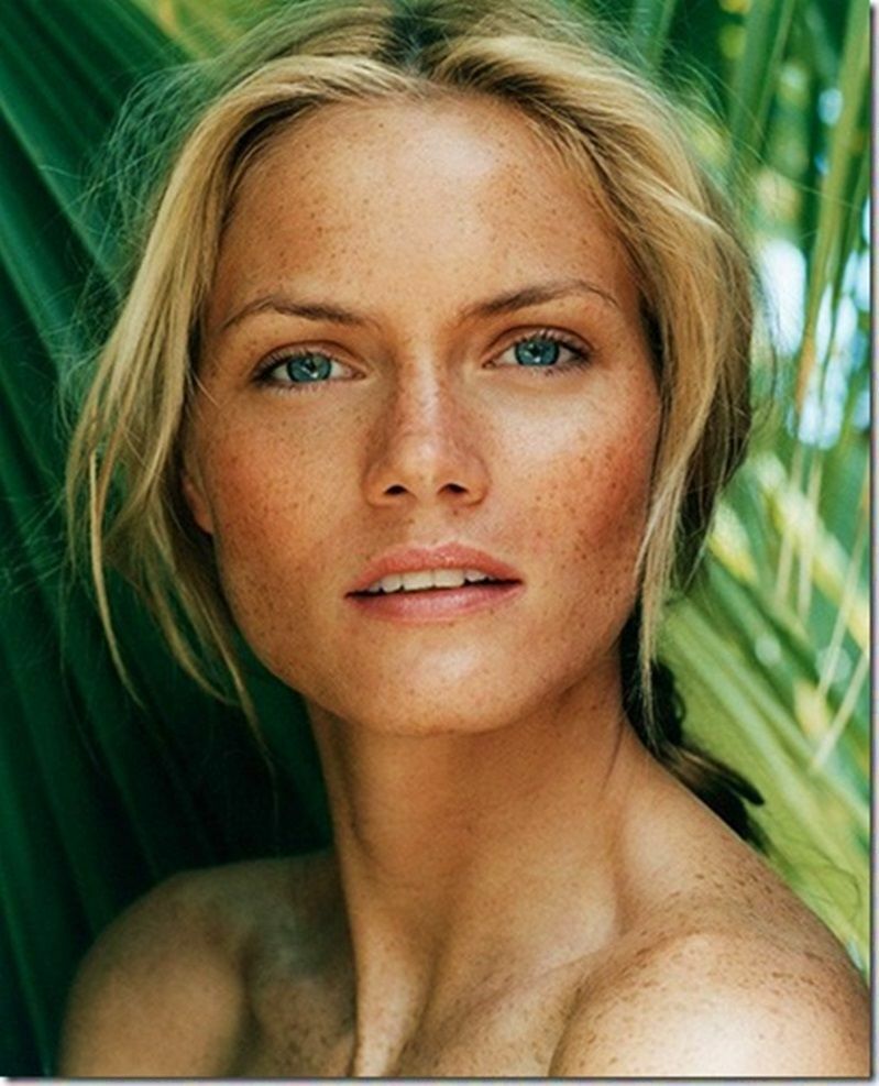 Rối loạn sắc tố da là gì - Rối loạn sắc tố da có chữa được không