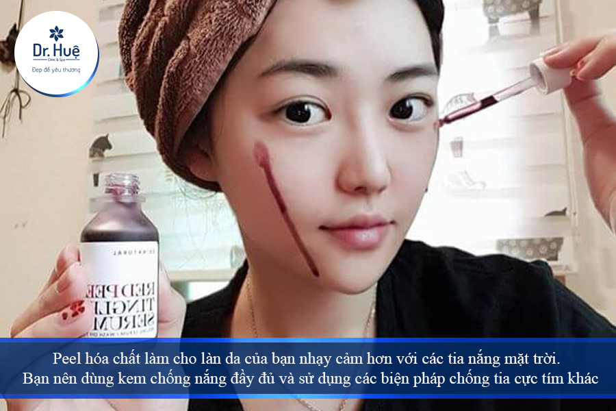 Peel hóa chất làm cho làn da của bạn nhạy cảm hơn với các tia nắng mặt trời. 