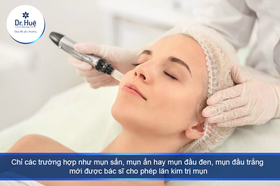 Địa điểm bạn lăn kim không uy tín 