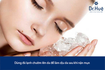 Sau Khi Nặn Mụn Nên Làm Gì Bôi Thuốc Gì Để Không Bị Thâm Và Nhanh Lành