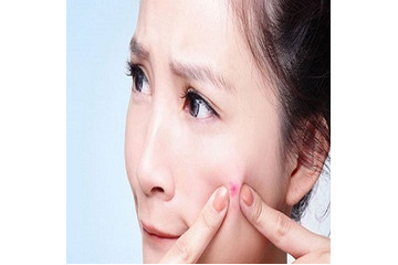 Sự khác nhau của các loại mụn trứng cá, mụn đầu đen, mụn bọc?