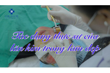 Tác dụng thực sự của lăn kim trong làm đẹp