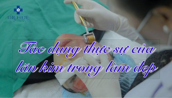 Tác dụng thực sự của lăn kim trong làm đẹp - Điều trị mụn Dr Huệ - Hình 1