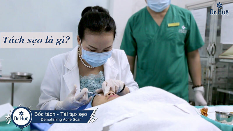 Tách sẹo là gì Tác dụng của tách sẹo?