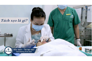 Tách sẹo là gì Tác dụng của tách sẹo?
