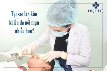 Tại sao Nano Basic xong mụn lại mọc nhiều hơn?