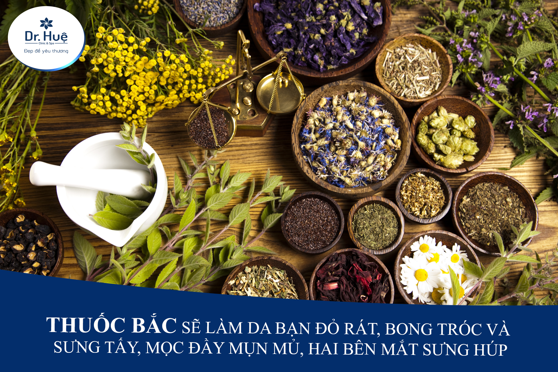 Nguồn gốc của thuốc bắc 