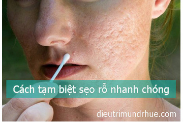 Tạm biệt sẹo rỗ thật nhanh chóng với phương pháp sau đây!!!!