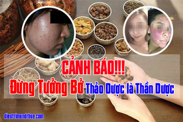 Thảo dược có phải “Thần Dược” để trị mụn hay không?