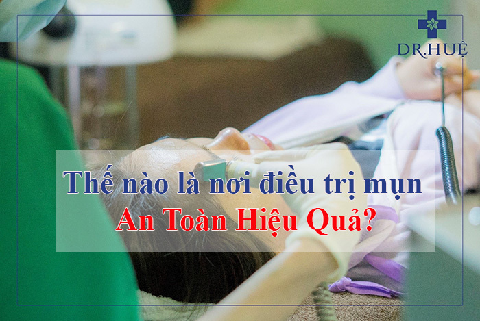Thế nào là nơi điều trị mụn an toàn hiệu quả?