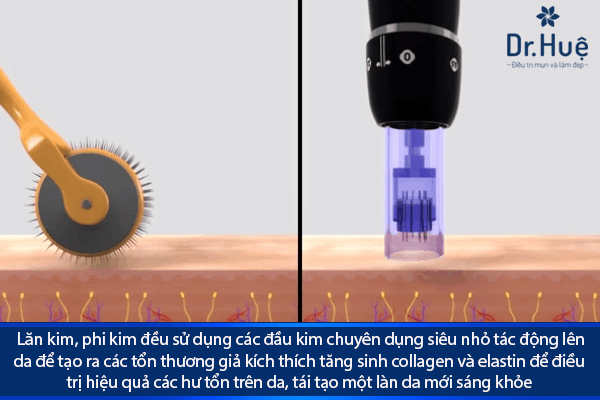 Thực Sự: Phi Kim Và Nano Basic Khác Nhau Như Thế Nào?