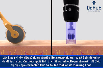 Thực Sự: Phi Kim Và Nano Basic Khác Nhau Như Thế Nào?