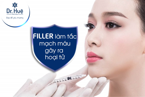 Rủi ro khi tiêm filler 