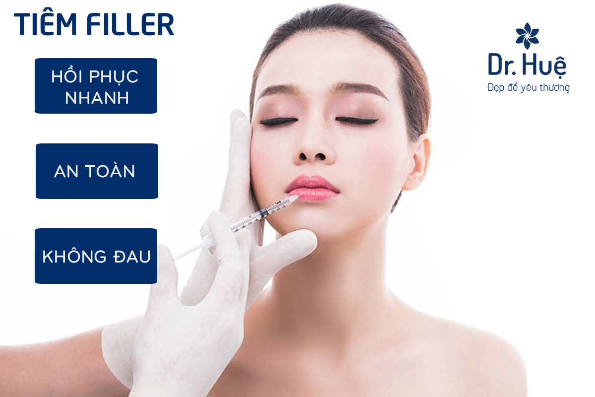 Lơi ích tiêm filler 