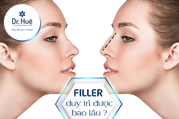 Tác dụng tiêm filler 
