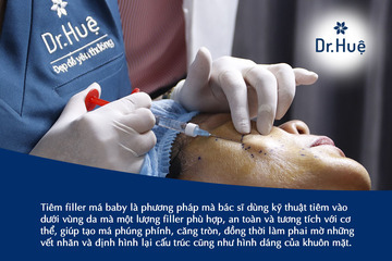 Tiêm má baby có nguy hiểm không, cần lưu ý những gì?