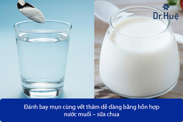 Tổng Hợp Các Cách Trị Mụn Bằng Nước Muối Hiệu Quả Tại Nhà