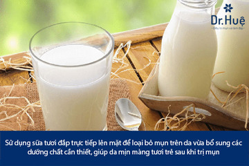 Tổng Hợp Các Cách Trị Mụn Bằng Sữa Tươi Không Đường Tốt Nhất