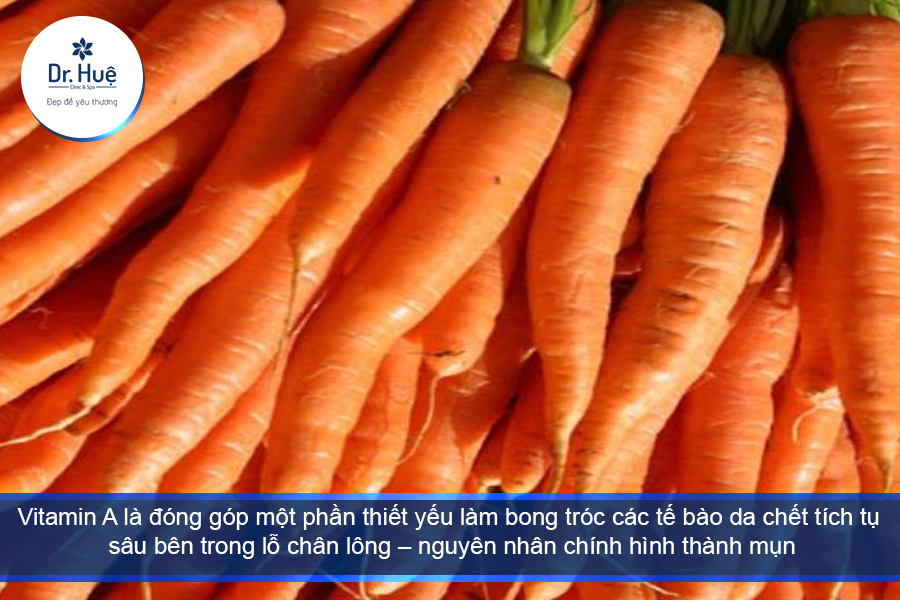 cà rốt chứa nhiều vitamin A , giúp điều trị mụn hiều quả 