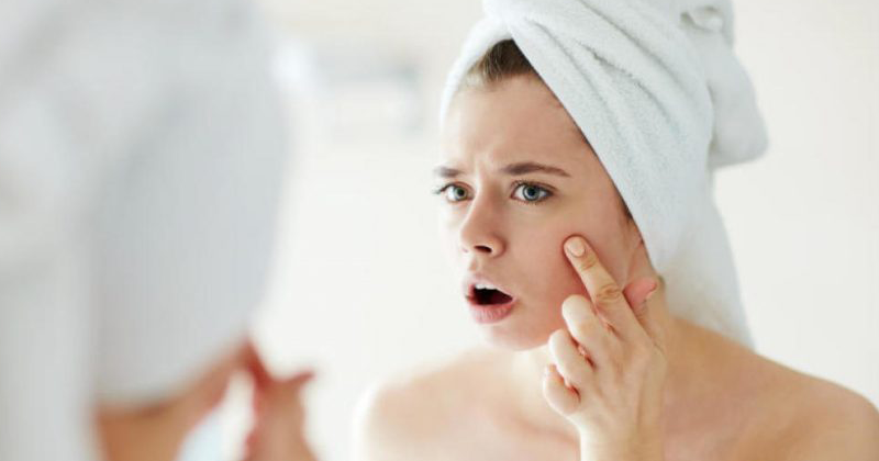 [Top 4] Cách làm trắng da mặt và hết mụn nhanh nhất