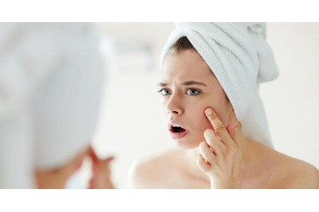 [Top 4] Cách làm trắng da mặt và hết mụn nhanh nhất