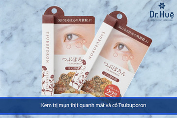 [Top 4] Loại Thuốc Trị Mụn Thịt Quanh Mắt Của Nhật Bản Mọi Người Hay Dùng