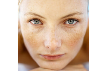 [TOP 5] Cách trị nám da mặt bằng trái cây hiệu quả tại nhà