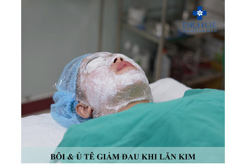 Top 5 thắc mắc thường gặp nhất về điều trị sẹo rỗ bằng Nano Basic