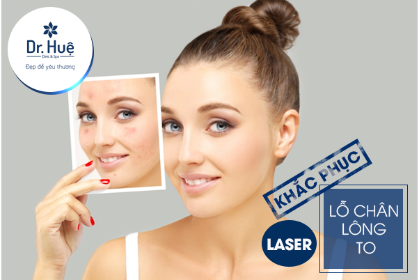 [TOP 20] Cách làm se khít lỗ chân lông trên da mặt tại nhà từ thiên nhiên