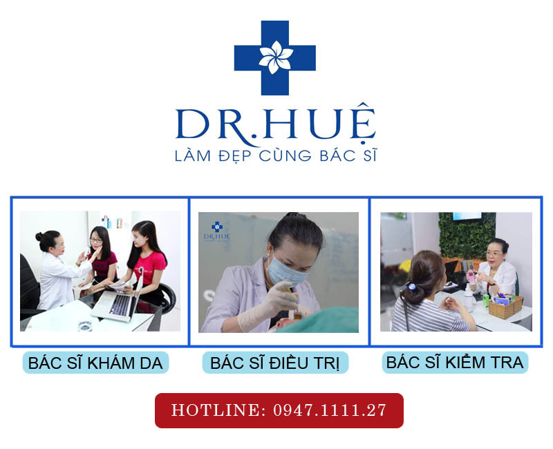 Điều trị mụn uy tín an toàn 100% hiệu quả
