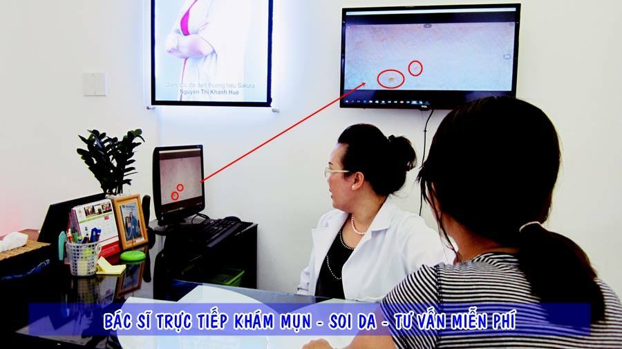 Trị mụn giá tốt cho học sinh, sinh viên