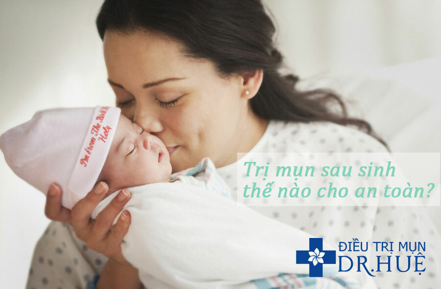 Trị mụn sau sinh thế nào cho an toàn?