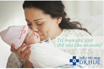 Trị mụn sau sinh thế nào cho an toàn?