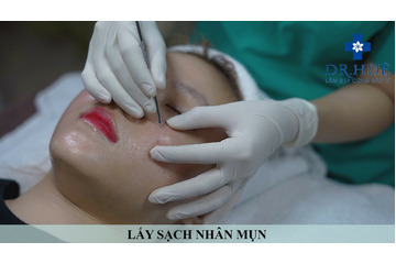 Trị mụn Trị sẹo ngay để kịp ăn Tết