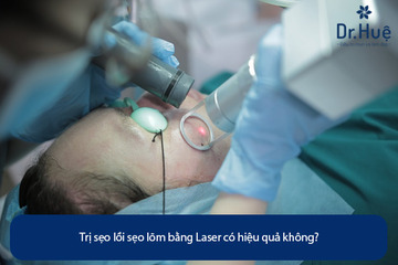 Trị Sẹo Lồi Sẹo Lõm Bằng Laser Có Hiệu Quả Không?