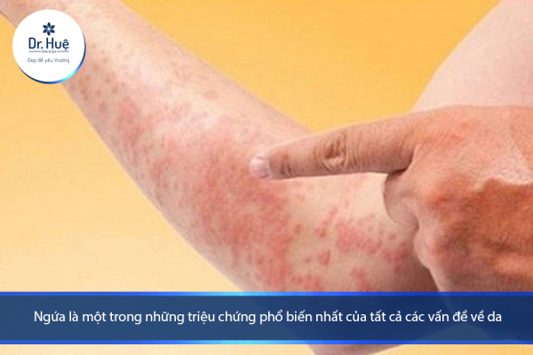 [Tư Vấn] Bị dị ứng da mặt nên làm gì?