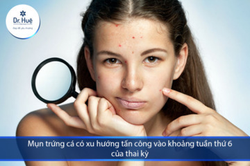 [Tư Vấn] Cách chăm sóc da mụn cho bà bầu an toàn