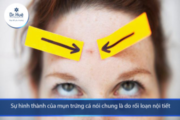 [Tư Vấn] Mặt tự nhiên nổi nhiều mụn bọc nên làm gì