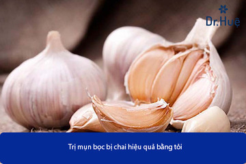 [Tư Vấn] Mụn Bọc Bị Chai Nên Làm Gì Là Tốt Nhât