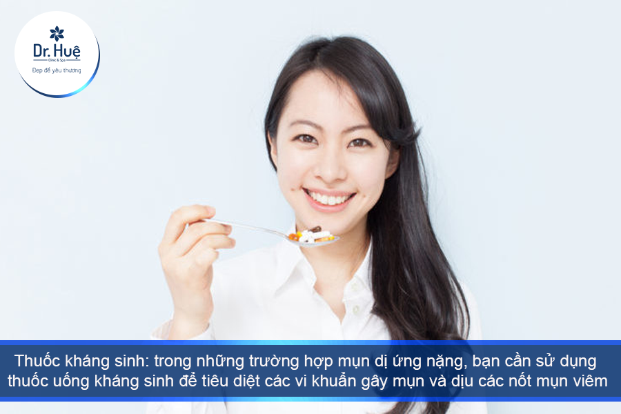 Thuốc kháng sinh trị mụn dị ứng 