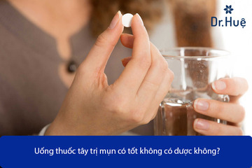 [Tư Vấn] Uống Thuốc Tây Trị Mụn Hiệu Quả Không Có Được Không