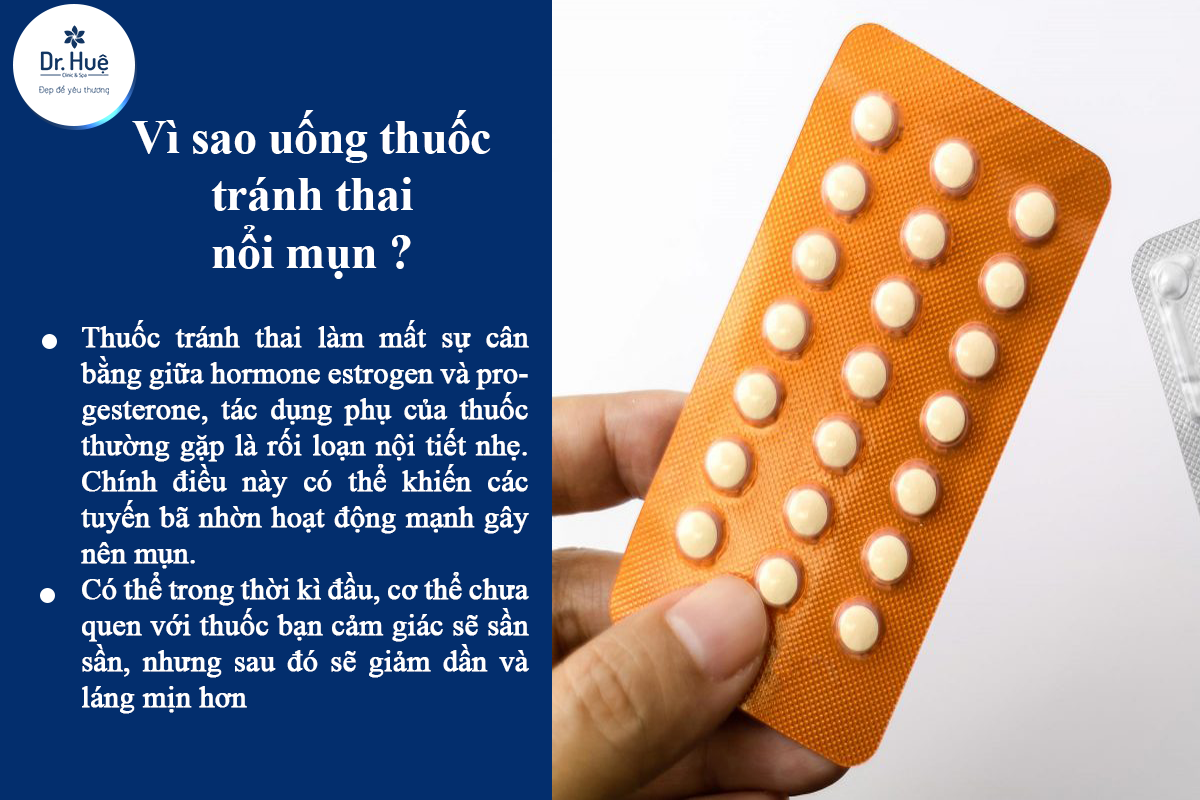 Uống thuốc tránh thai nổi mụn 
