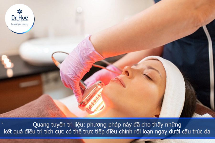 Quang tuyến trị liệu 